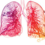 Health Effects of Indoor Air Pollution