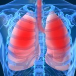 Indoor Air Pollution and Asthma